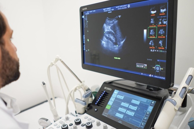 l'echographie 4D est une des nombreuses avancées de la radiologie moderne
